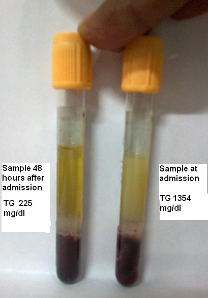A preanalytical problem or something more?