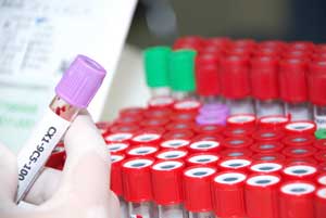 High-Sensitivity Assays