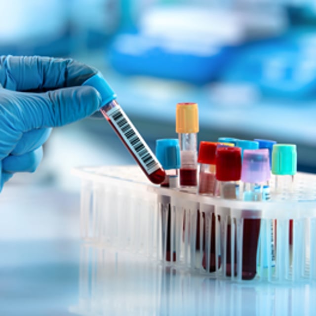blood samples