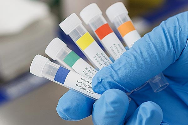 Hand holding test tubes with colored labels.