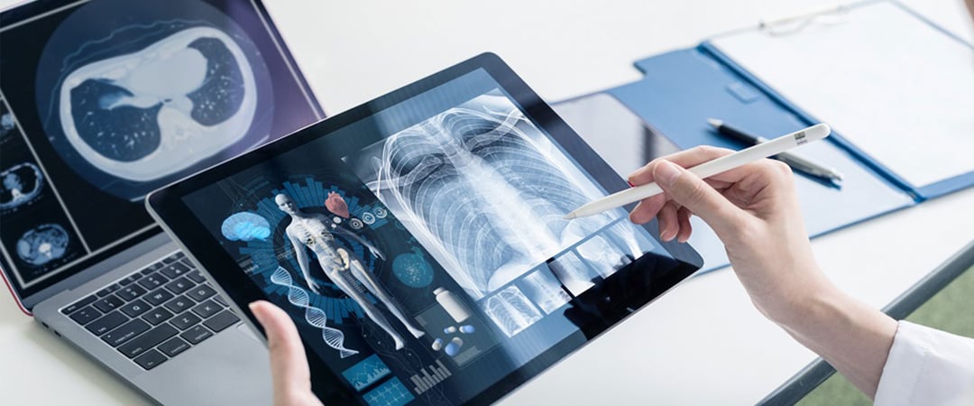 Medical professional looking at x-rays on a tablet device