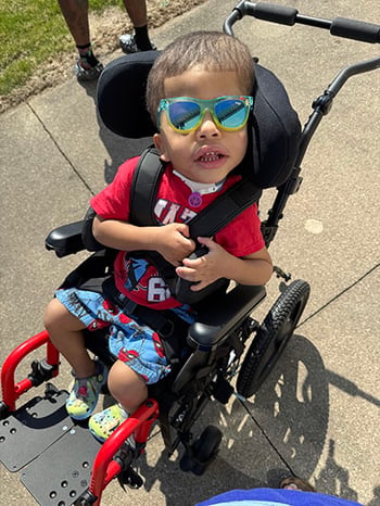 Ben Coffin-Siris syndrome Children's Wisconsin