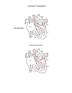 Double Switch Procedure illustration 1