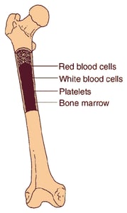 Diagram of bone blood for marrow treatment for Immunodeficiency
