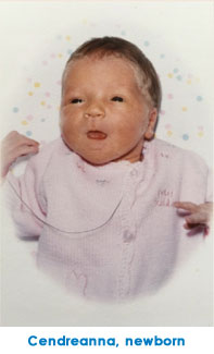 Patient, Cendreanna as a baby when she arrived to Children's.