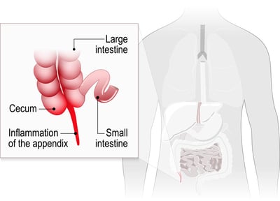 Appendix Graphic