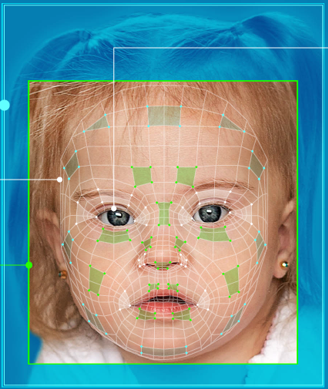 Face2Gene6