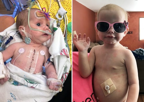 Hazel before and after