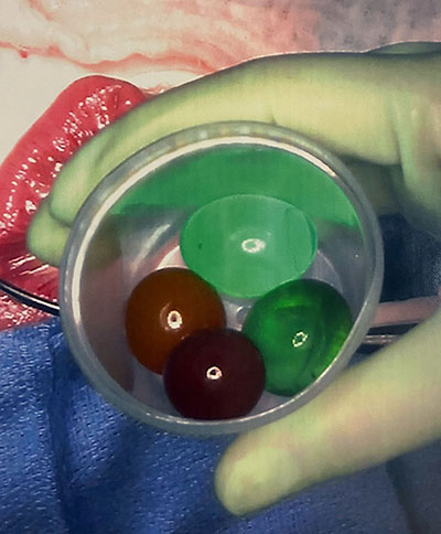 Deacon water beads danger Children's Wisconsin