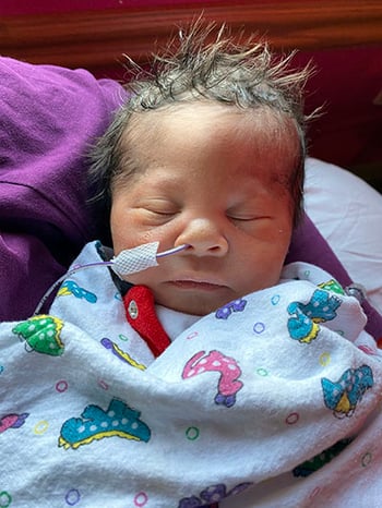 Ben Coffin-Siris syndrome Children's Wisconsin