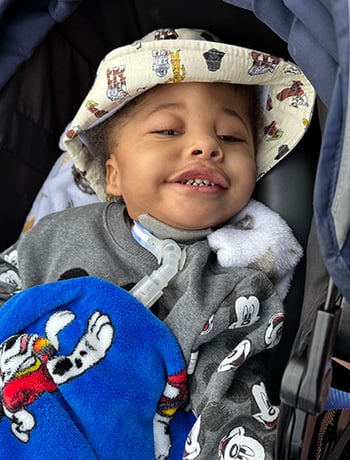 Ben Coffin-Siris syndrome Children's Wisconsin