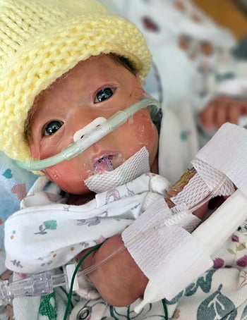 Alayna Children's Wisconsin NICU March of Dimes