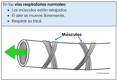 normal airway