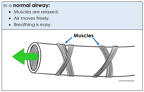 normal airway