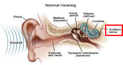 Diagram of a normal ear