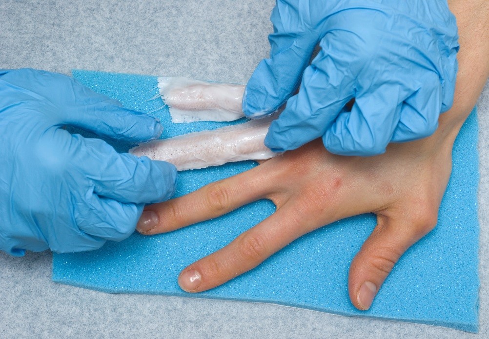 Gloved hands putting first layer of gauze on 2 fingers