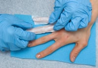 Gloved hands putting first layer of gauze on 2 fingers