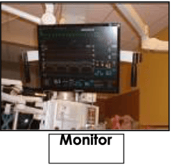 Monitor above patient bed