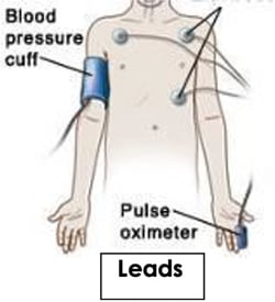 diagram of how blood pressure is monitored 