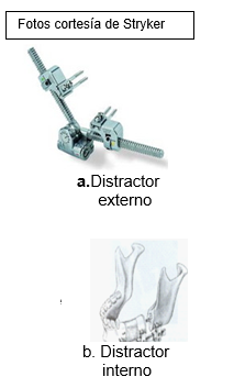 Mandibular 2 images SP