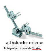 Distractor extemo