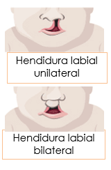 2 Cleft images with text SP