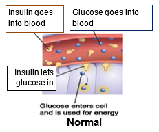 Insulin img A