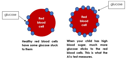 Hemoglobin A1c test