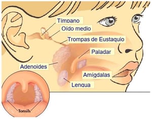 Laringoscopia