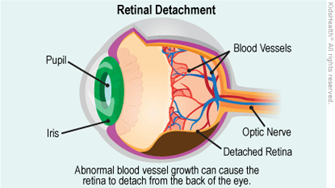 retinal