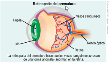 Retinopathy