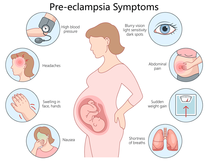 Pre-eclampsia