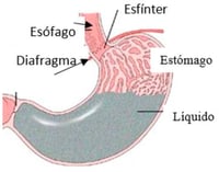 Gastro reflex