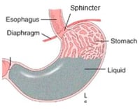 Gastro reflex