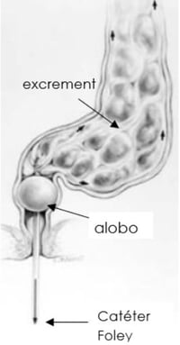 Stool diagram