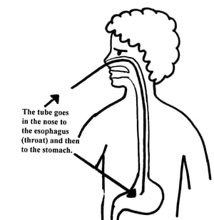Nose tube