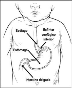 Stomach Diagram Spanish