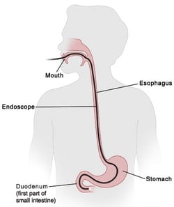 gi anatomy