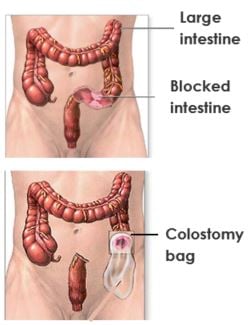 colon anatomy