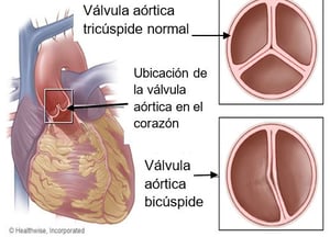 heart valve
