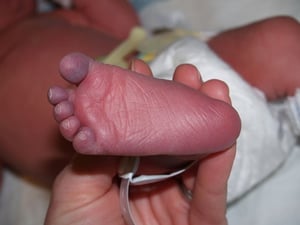 foot