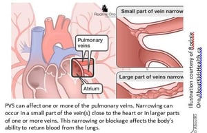 heart vein