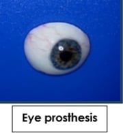 eye prothesis