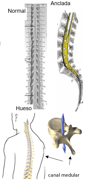 two spinal cord pics