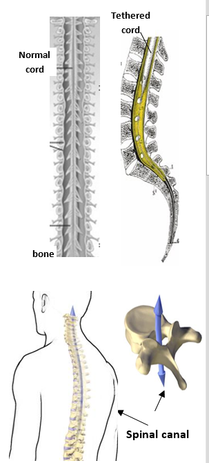 two spinal cord pics