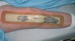 bandage on knee