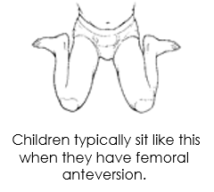 Femoral