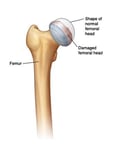 diagram of hip