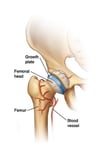 diagram of hip