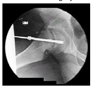 how surgery is done